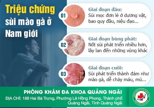 Sùi mào gà